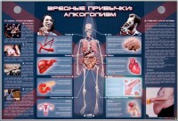 Электрифицированный стенд "Вредные привычки: алкоголизм" - fgospostavki.ru - Барнаул