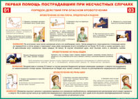 Таблица "Порядок действий при опасном кровотечении" (100х140 сантиметров, винил) - fgospostavki.ru - Барнаул
